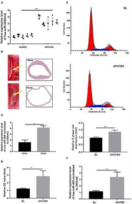 Potential Target miR-455 Delaying Arterial Stenosis Progression Through PTEN